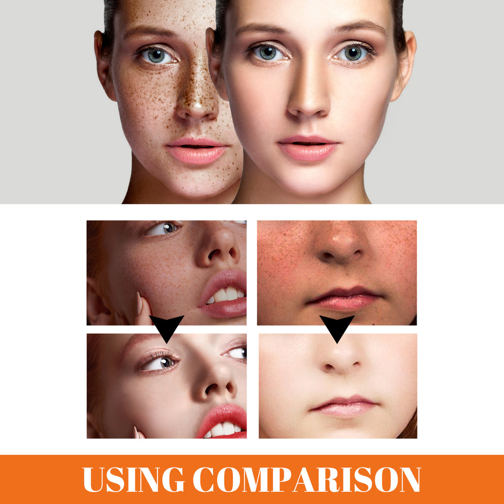 Eelhoe Papaya Whitening Que Spot Cream Fade Facial Freckles Dark Spot Brightening Moisturizing Skin Day & Night Cream