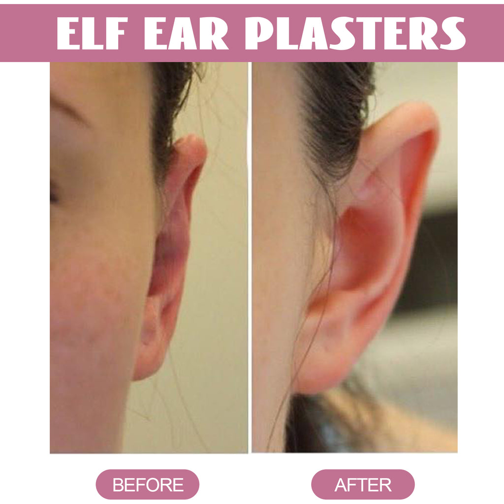 Eelhoe Elf Ear Veneer Ear Wind Ear Show Face Small Invisible and Breathable Waterproof Correction Ear Magic Tape