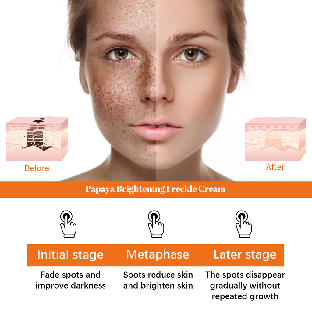 Eelhoe Papaya Whitening Que Spot Cream Fade Facial Freckles Dark Spot Brightening Moisturizing Skin Day & Night Cream