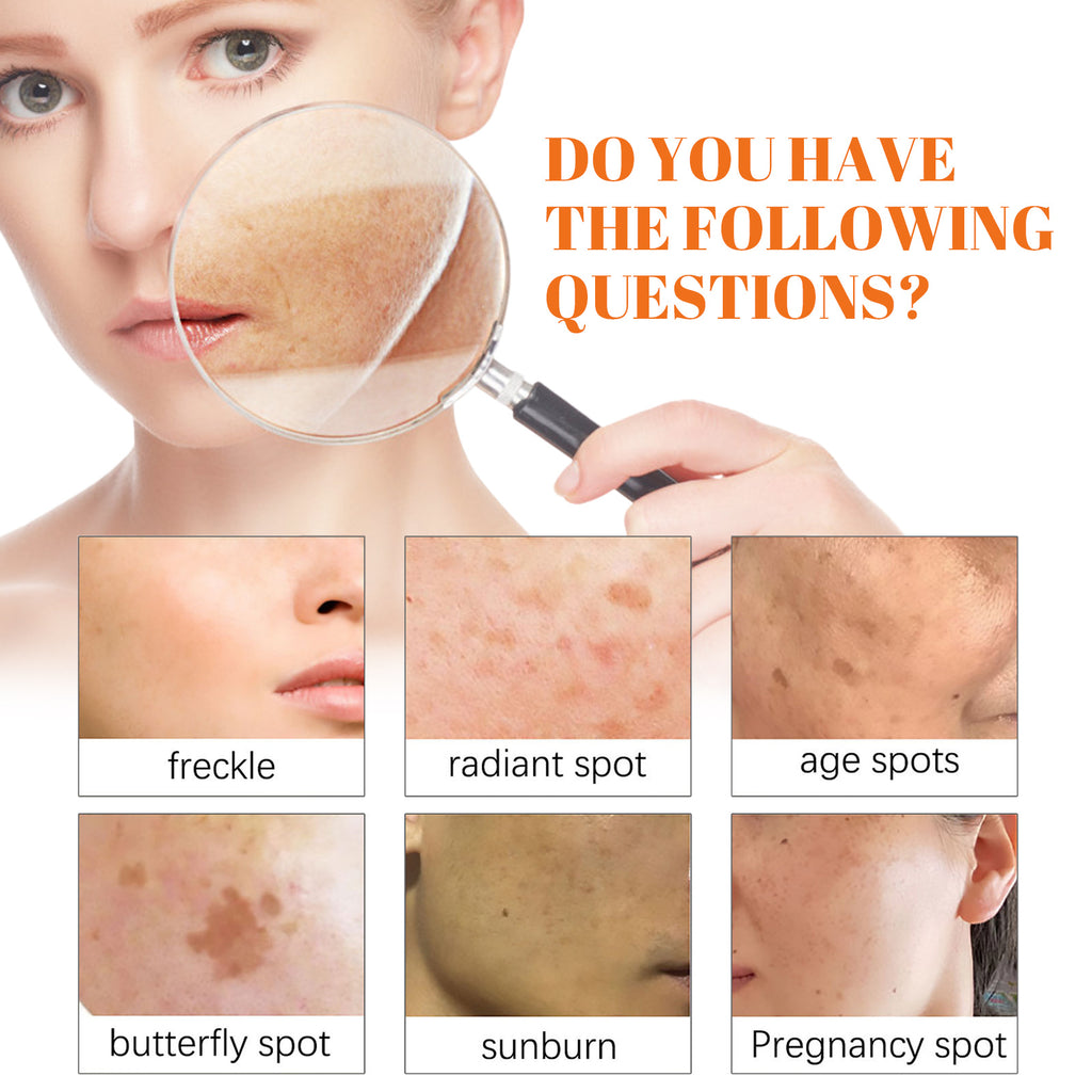 Eelhoe Papaya Whitening Que Spot Cream Fade Facial Freckles Dark Spot Brightening Moisturizing Skin Day & Night Cream